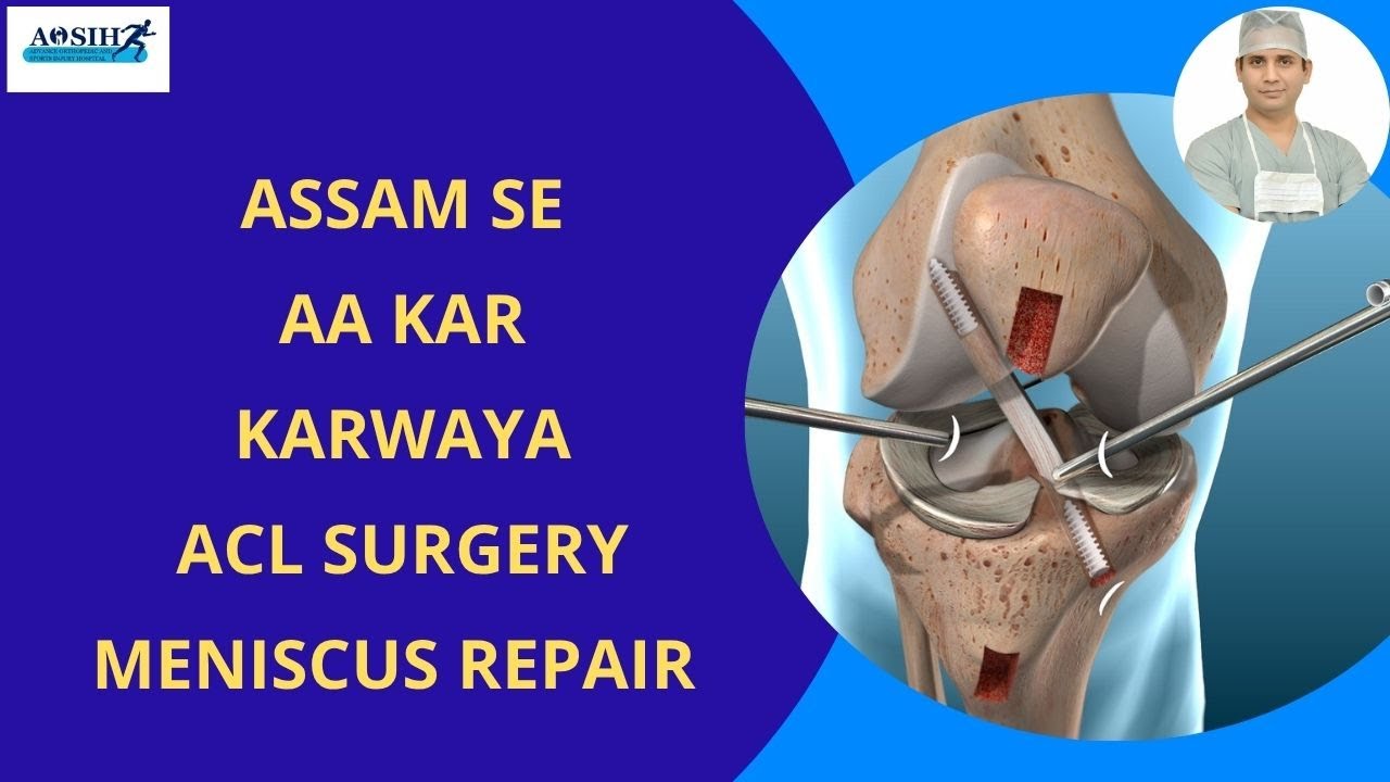 Assam se aa kar karwaya ACL aur meniscus ka treatment / mila best ilaz #acl #aclsurgeryrecovery