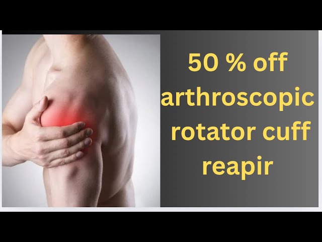 Rotator cuff treatment arthroscopy se 50 % discount me