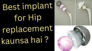 hip replacement me kya kya use hota hai hindi me complete information