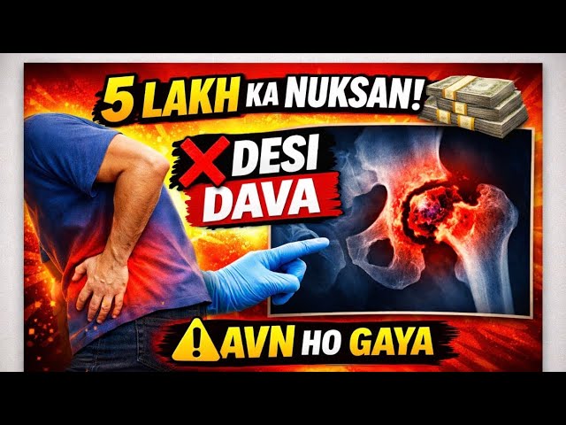 Hip AVN me desi davao kee wajah se huye 5 lakh rupye waste ! DAA MIS se mila Aram